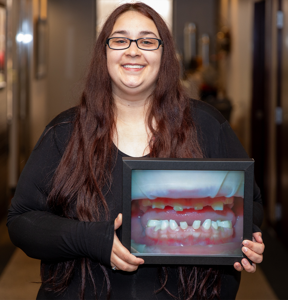 a full mouth dental implant candidate holding up a before photo and smiling.