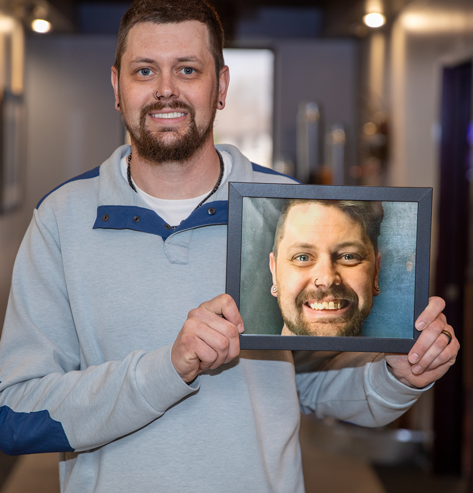 a male patient smiling holding up his before photo of his smile